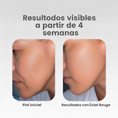 Éclat Rouge - Máscara facial luz roja
